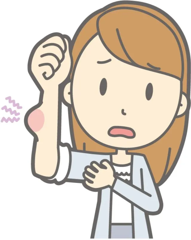 腕を虫に刺された女性